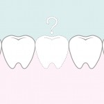永久歯が生えてこない…原因と治療方法（先天性欠如・埋伏歯）