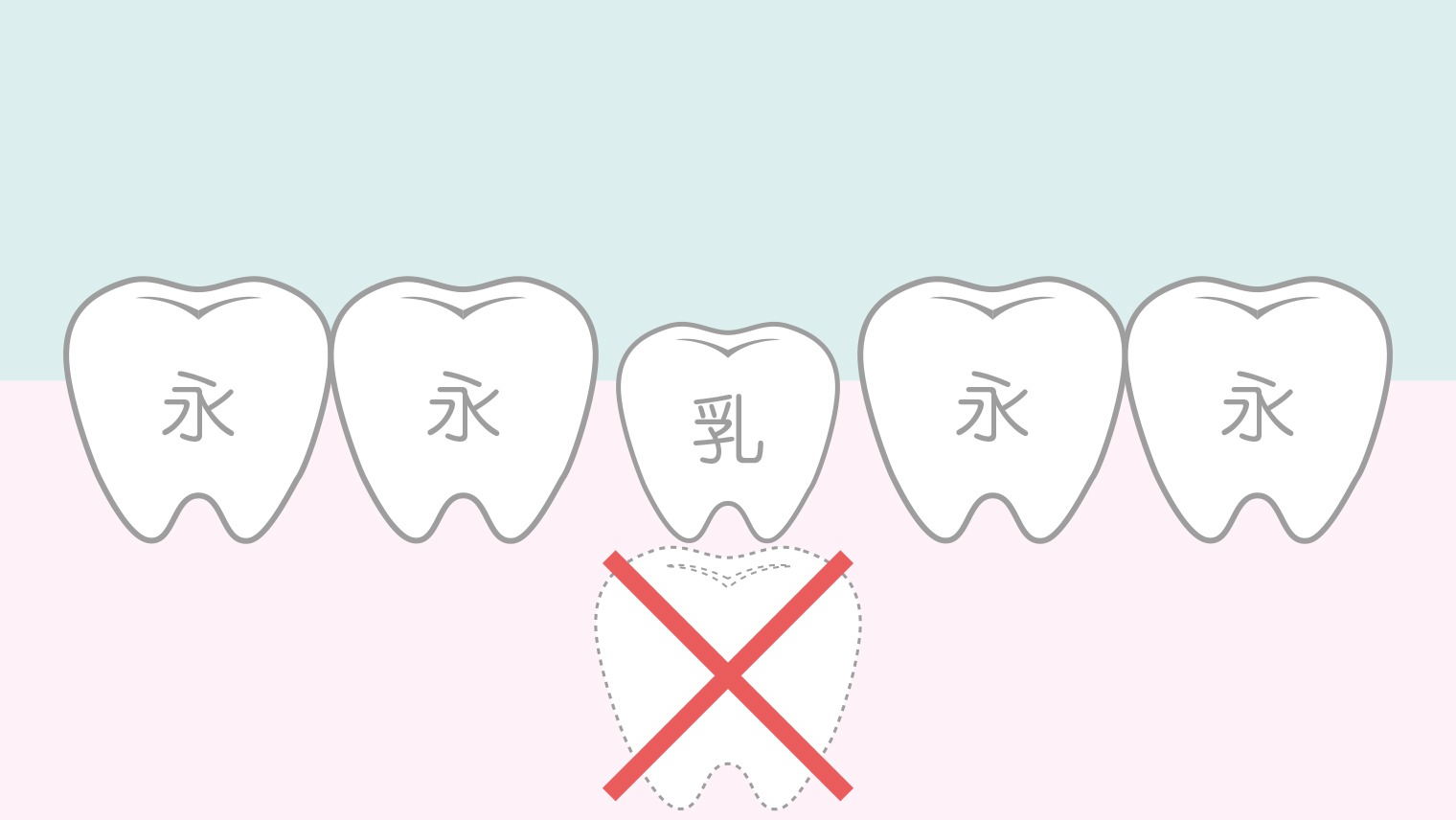 永久歯が生えてこない…原因と治療方法（先天性欠如・埋伏歯）
